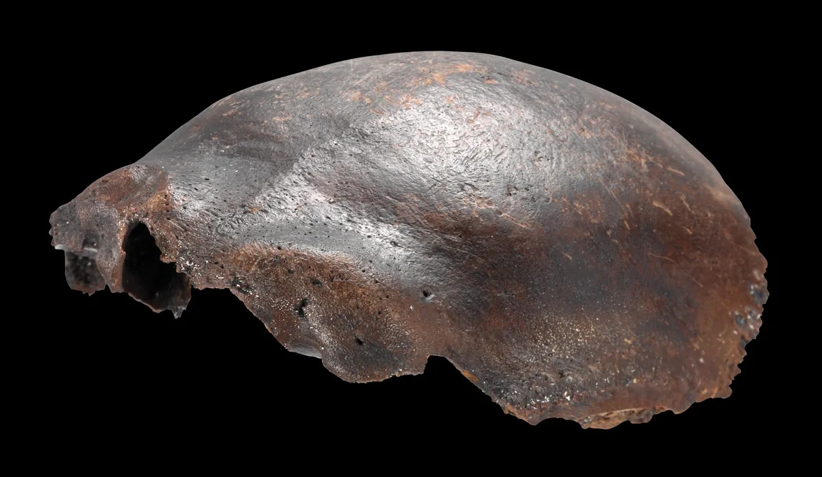human-skull-bone-from-hahnofersa-1777347566077-17773475665131606637936-1