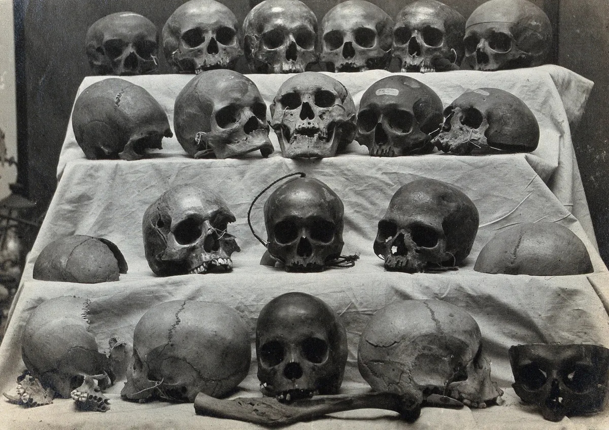 skull-l-1777689064681-17776890651261299676324 Các nhà khoa học phát hiện hộp sọ con người đã thay đổi rõ rệt chỉ sau 100 năm khiến giới nghiên cứu bất ngờ - Ảnh 1.